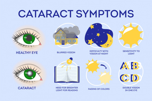 infographic illustration describing cataracts symptoms